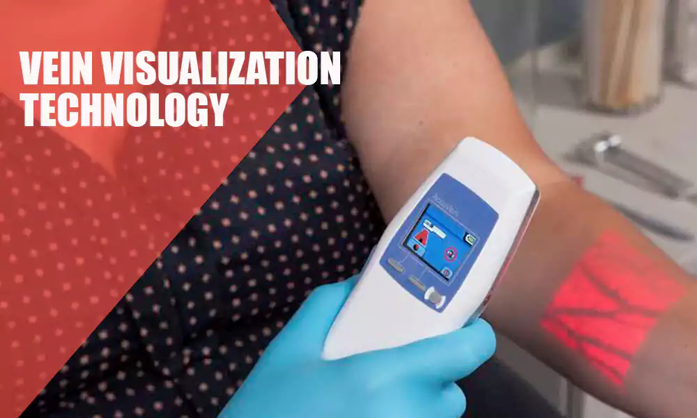 What are the Benefits of Vein Visualization Technology