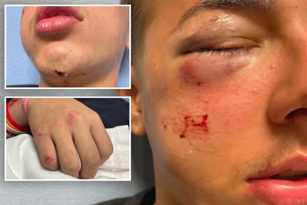 Delaware trooper suspended for allegedly beating 15-year-old who ding-dong ditched his house