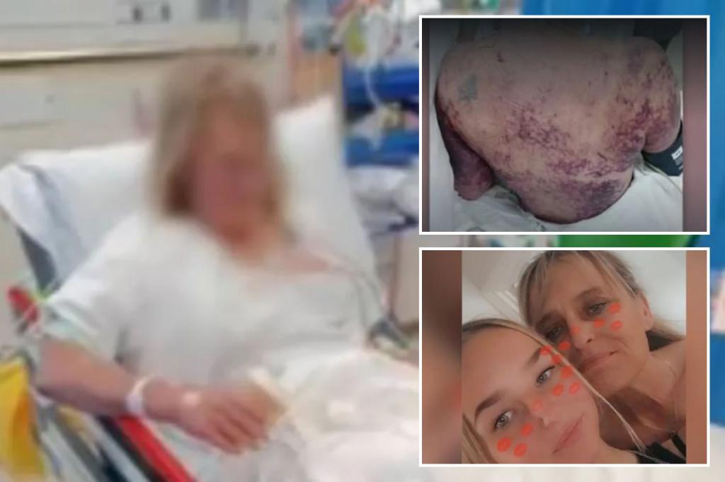 Dog bite results in ‘extremely rare’ infection, kills Australian mother-of-two