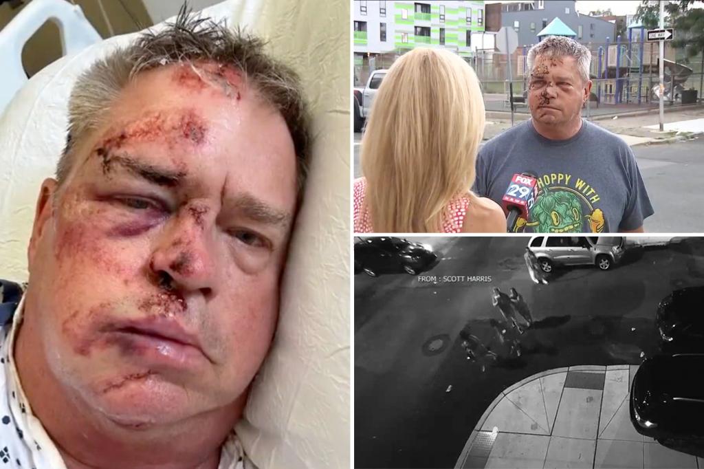 Navy veteran brutally beaten while walking his dog in Philadelphia: ‘Not have expected this to happen in my own neighborhood’