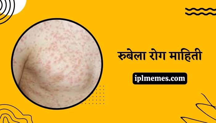 Rubella Disease Information in Marathi