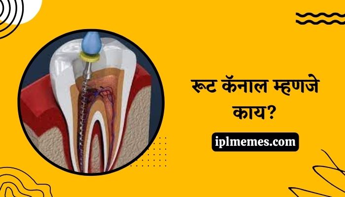 Root Canal Treatment Information in Marathi