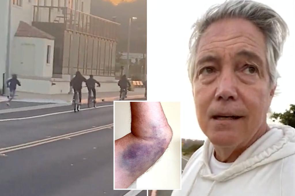 California reporter assaulted by teens who tried to steal his bike: ‘Sorry to see our city like this’