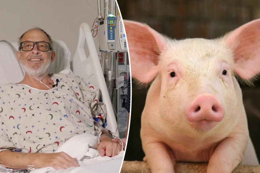 Second-ever pig heart transplant saves dying man: ‘Now I have hope’