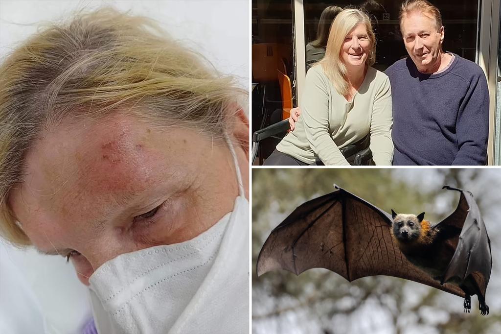 Tourist bitten by bat feared to have fatal virus: ‘I didn’t want to believe it’