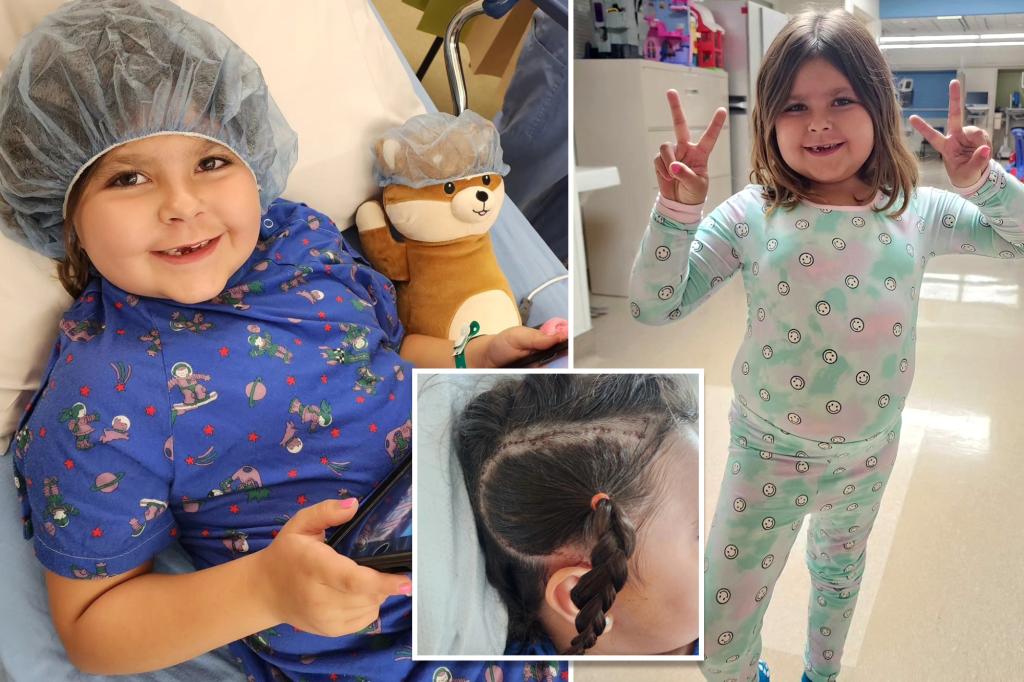 California doctors switch off half of 6-year-old girl’s brain to stop devastating disease