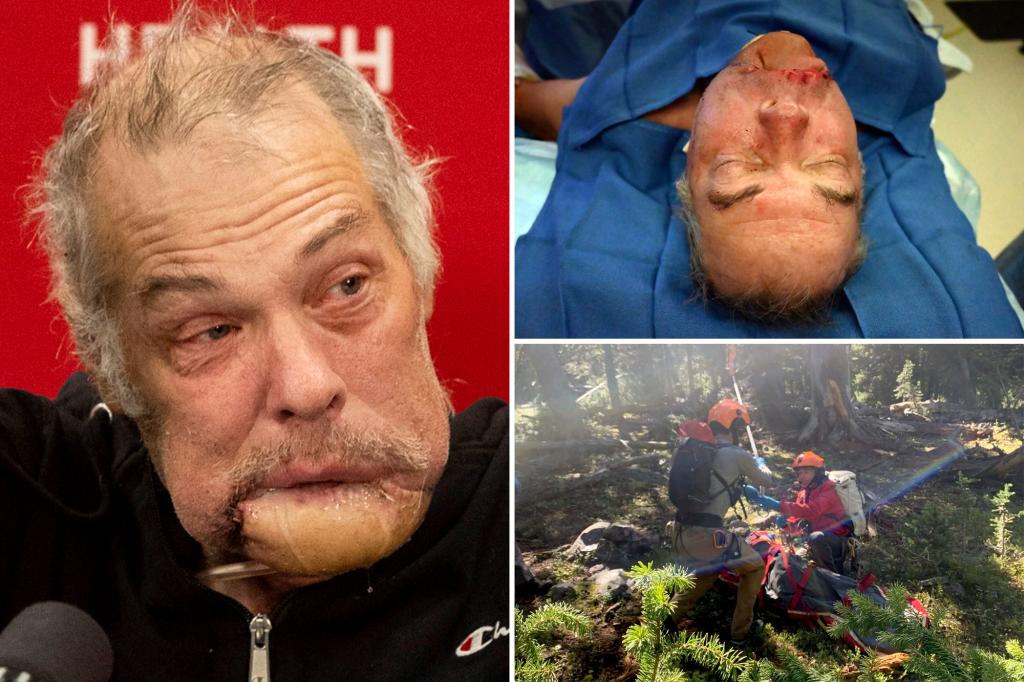 Navy vet who lost jaw in grizzly bear attack eager to return to Montana for ‘round two’