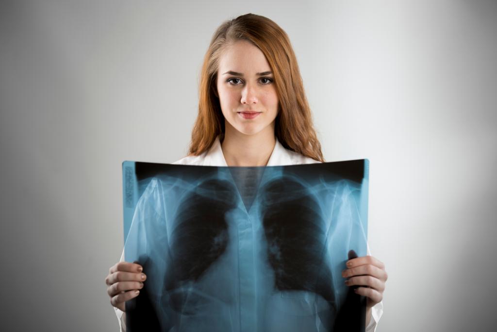 Young women get lung cancer at higher rates than men â docs don’t know why