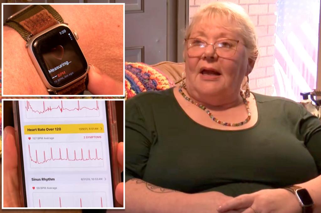 Woman’s Apple Watch helped diagnose her diabetes after it first detected her heart problem