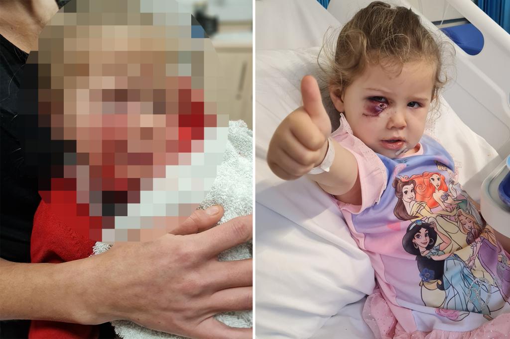 3-year-old girl mauled by dog on play date, leading to hours-long facial surgery