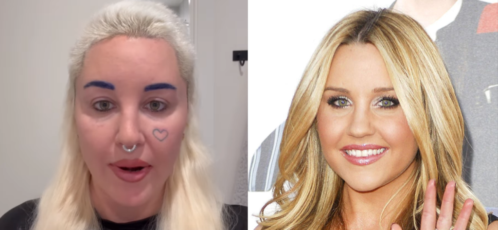 Amanda Bynes Reveals Drastic Plastic Surgery Removing ‘Skin Folds’ From Eyes