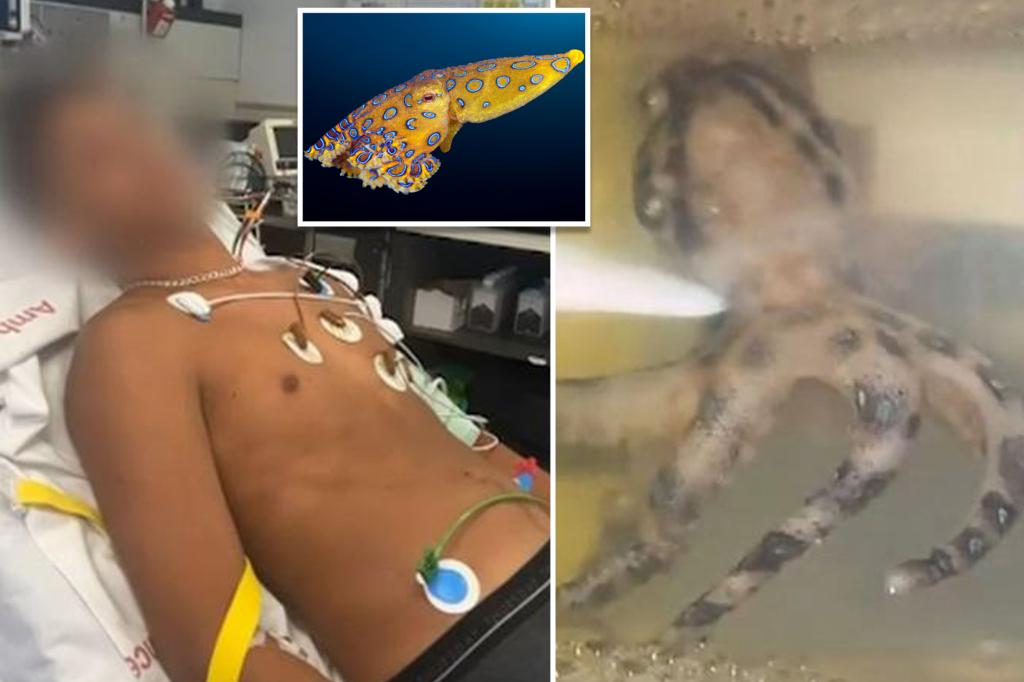 Australian teen nearly dies after collecting shell hiding blue-ringed octopus