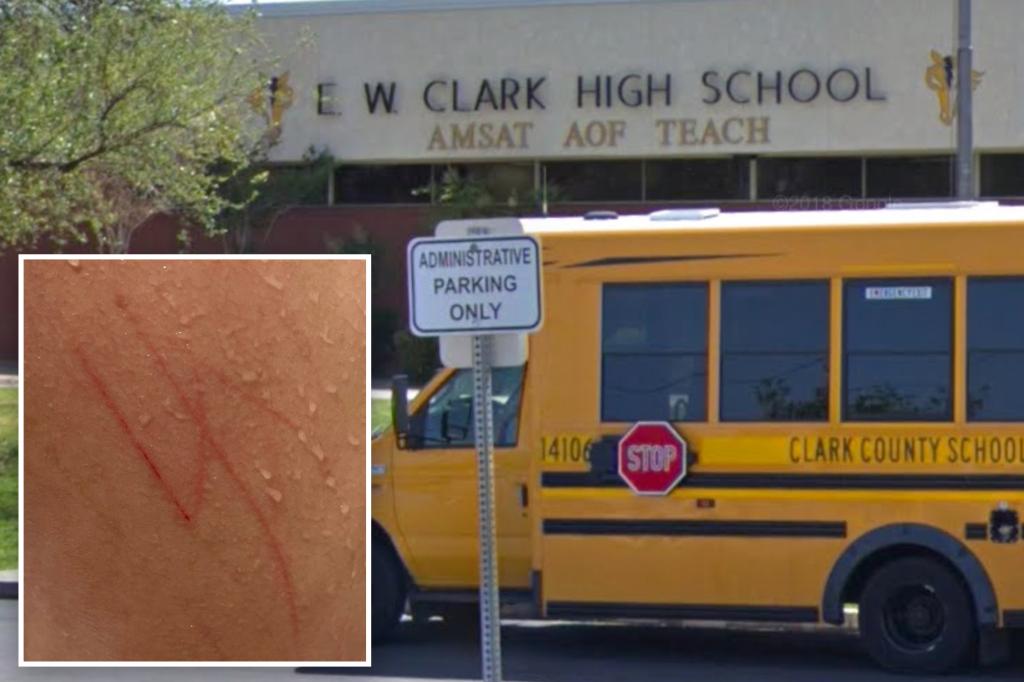Family of autistic Jewish teen who had swastika carved on his back by classmates sues school