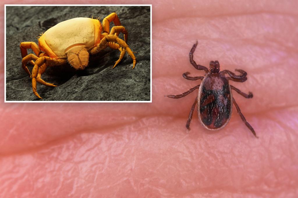 Rocky Mountain Spotted Fever Outbreak Kills Three In California CDC 