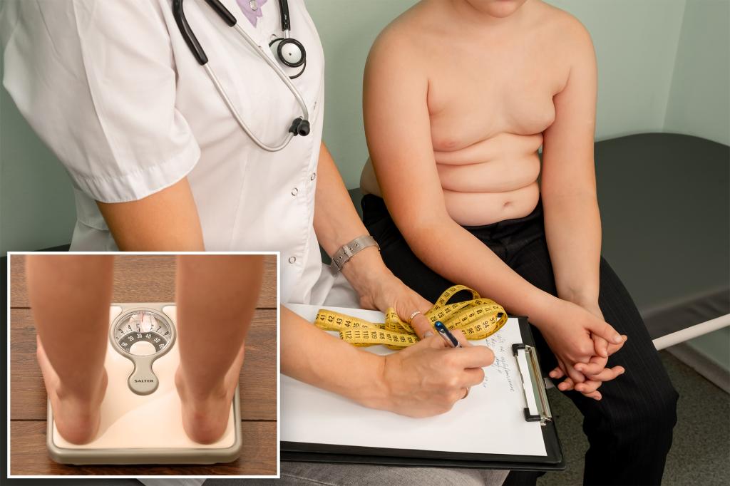 Study bolsters evidence that severe obesity increasing in young US kids