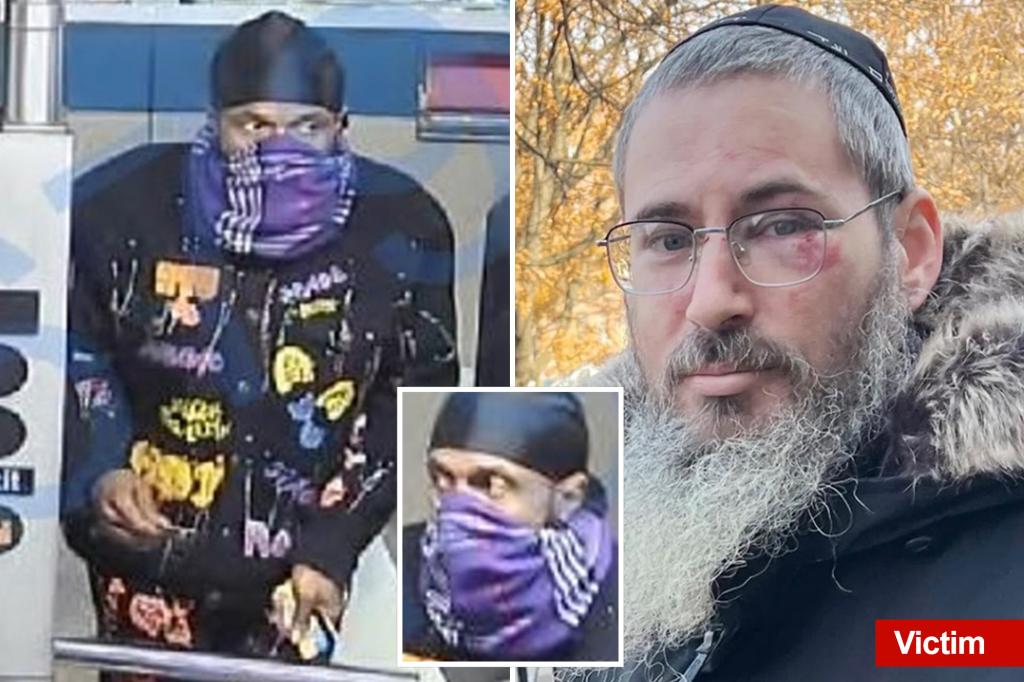 Two more Jewish hate attacks in as many days in NYC: ‘It was a real beating’