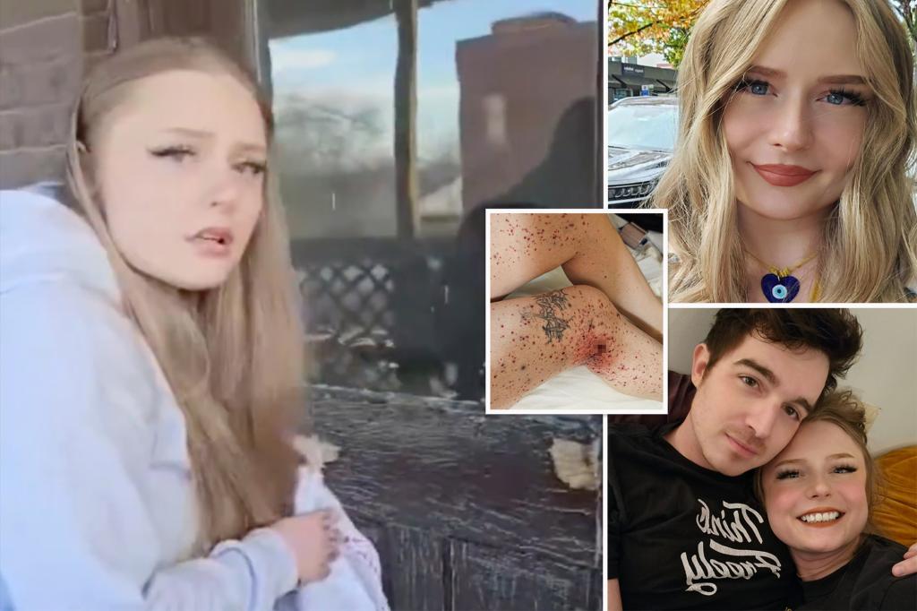 Video captures popular YouTuber’s stricken girlfriend moments after ex-boyfriend shoots her — before killing himself
