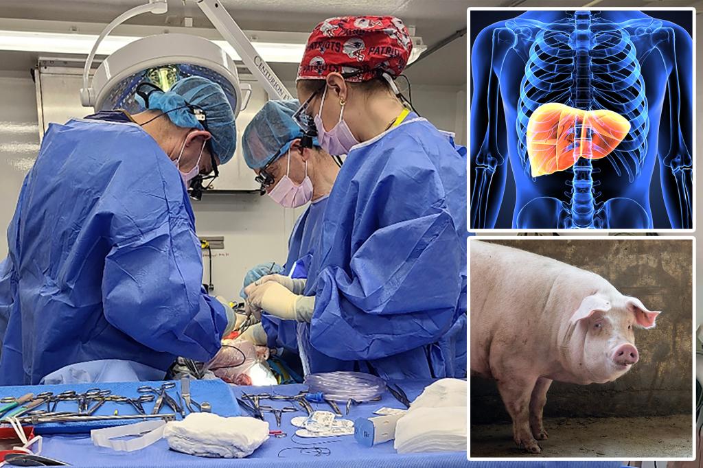 A first-ever experiment shows how pigs might one day help people who have liver failure