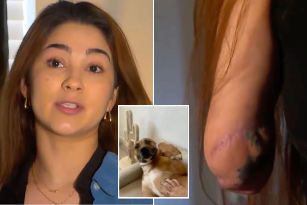 Grad student loses arm after being mauled by stray dog she took in: ‘I danced with the devil’