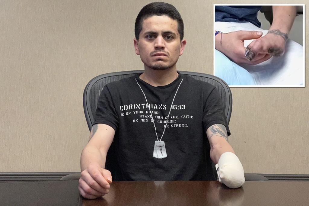 Suspect alleges he was handcuffed so tightly, his hand had to be amputated