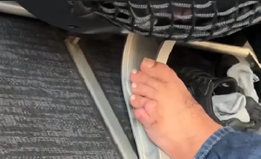 Passenger causes fever because of sixth toe on flight