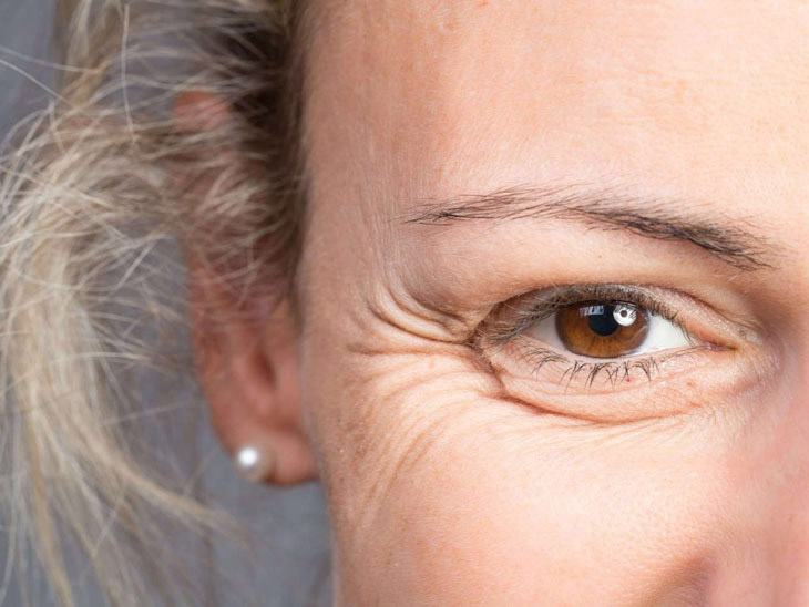Dấu hiệu lão hoá và 8 cách chăm sóc vùng da mắt